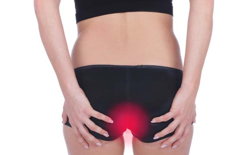 Aranyér: elkerülendő sportok és egyéb tabuk